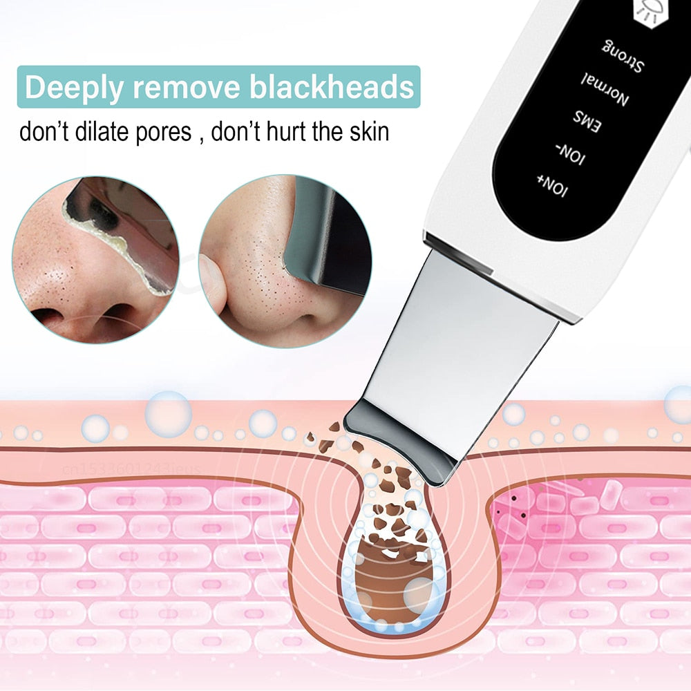 Ultrasonic Skin Peeling Scrubber